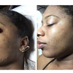 Skin Care By Marlene