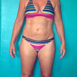 Personalized Nutrition Concepts