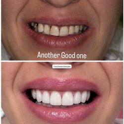 Encino Dental Studio-Amir Jamsheed, DDS