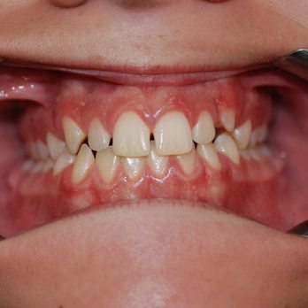 Smileodontics - Orthodontists Near Me - Mason, Ohio Smileodontics - Orthodontists Near Me - Mason, Ohio