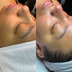 Lexaskin Wax & Beauty Bar - Before & After - 90 Minute Custom Facial