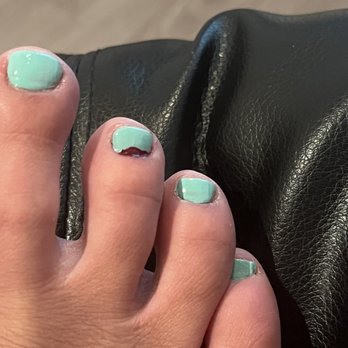 Nail Court - My messed up, bloody toenail. - Nail Salons Near Me - Dallas, Texas Nail Court - My messed up, bloody toenail. - Nail Salons Near Me - Dallas, Texas