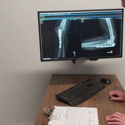 University Orthopedics - Brilliant Dr Andrew Evans put my left elbow together after a solo bicycle accident. Can't thank Univ Ortho enough!