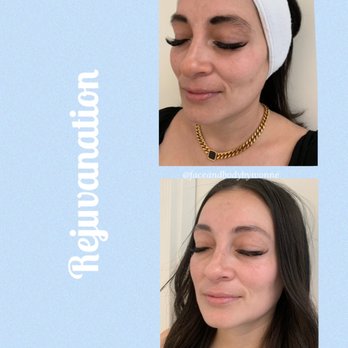 Bella Estetica - Skin Care Near Me - Chandler, Arizona Bella Estetica - Skin Care Near Me - Chandler, Arizona