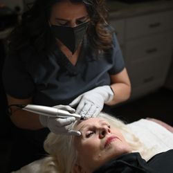 Radiant Aesthetics - Plasma Pen great for hooded eyes, under eyes, skin tags and moles.