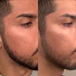 Glowdega - Majestic No. 8 before and after