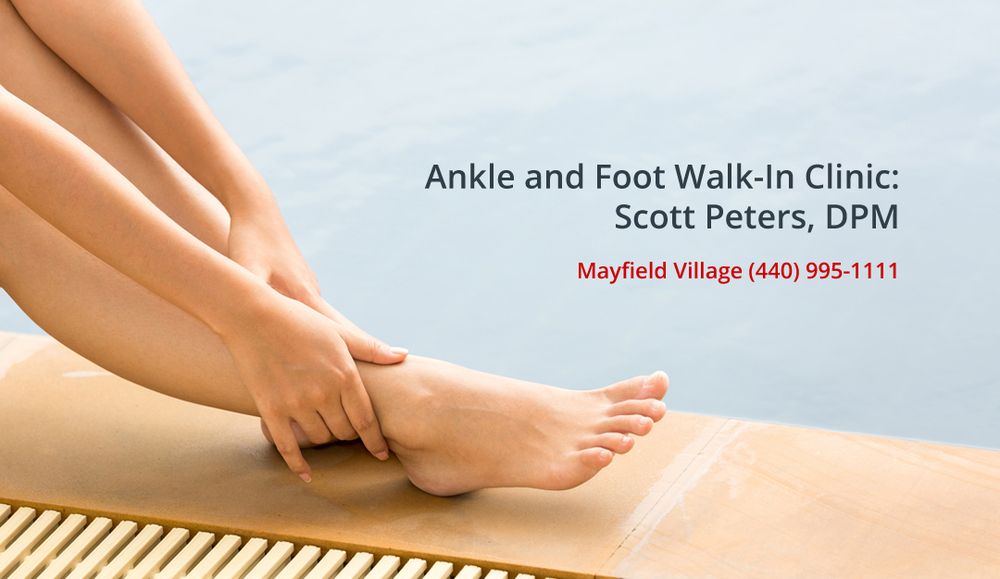 ANKLE AND FOOT WALKIN CLINIC Updated October 2024 730 Som Center Rd, Mayfield, Ohio