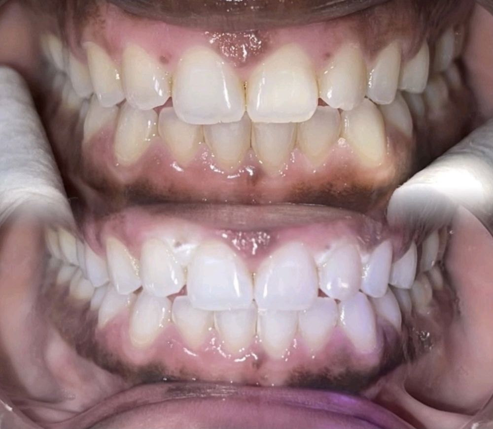 BELLE DAME BEAUTY Houston, Texas Teeth Whitening Yelp