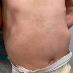 Charleston ENT & Allergy