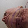 Photo of Lloyd D Landsman MD