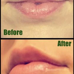 Austin Skin & Wellness - The before and after that changed my life!