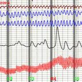 Tri-Valley Polygraph - Polygraph Tracings - Professional Services Near Me - Livermore, California Tri-Valley Polygraph - Polygraph Tracings - Professional Services Near Me - Livermore, California