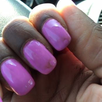 Classy Nails - Brown discoloration on the nails, and it's not smooth. It hasn't been one week yet - Nail Salons Near Me - Lynwood, California Classy Nails - Brown discoloration on the nails, and it's not smooth. It hasn't been one week yet - Nail Salons Near Me - Lynwood, California