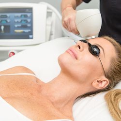 Laser Skincare - Rochester