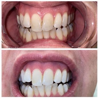 Handsome Beauty Bar 2 - Teeth whitening - Eyelash Service Near Me - San Jose, California Handsome Beauty Bar 2 - Teeth whitening - Eyelash Service Near Me - San Jose, California