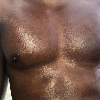 Creed Esthetics - After waxing - Skin Care Near Me - Brooklyn, New York