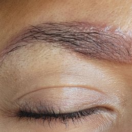 Irritation from over processed brow lamination. Irritation from over processed brow lamination.