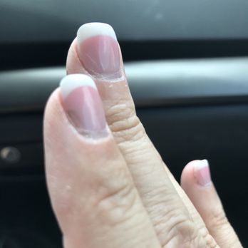 T Nails & Spa - Brown spots developing under the nails 9 days after getting them done. - Nail Salons Near Me - Austin, Texas T Nails & Spa - Brown spots developing under the nails 9 days after getting them done. - Nail Salons Near Me - Austin, Texas