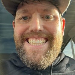 Clinton R Harrell, DDS - Front left tooth with new crown!