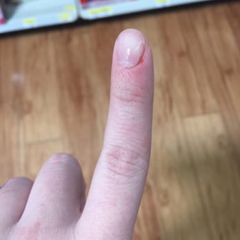 Vip Nails & Spa Pasadena - The less severe cut cuticle. - Nail Salons Near Me - Pasadena, Texas Vip Nails & Spa Pasadena - The less severe cut cuticle. - Nail Salons Near Me - Pasadena, Texas