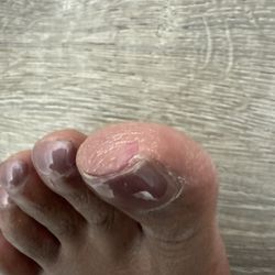 Asian Nails and Spa - Skin cut deep on top of big toe above nail.