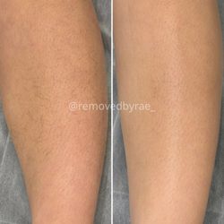 Removed by Rae - Leg Sugaring #SugaringNearMe #SugaringBrazilian #BrazilianSugarWax #LegWaxing #WoodlandHills #SugarWaxBrazilian