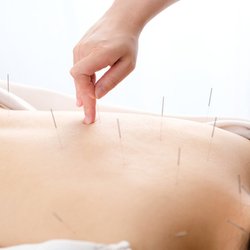 Precision Healing - Lei Wang Acupuncture at Precision Healing