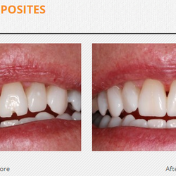 Felton Dental Care