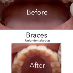 Union Dental Center