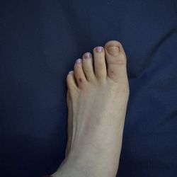 Dazzling Nails Spa - Rash and broken toenail!!