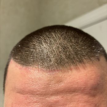 Max's Hair and Nails - Cut my skin as she did the line up. - Hair Salons Near Me - San Jose, California Max's Hair and Nails - Cut my skin as she did the line up. - Hair Salons Near Me - San Jose, California