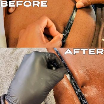 JUST | CRYO - CRYO SHAPING
Area: Abdomen
Before treatment:
36 inches
After treatment:
34.50 inches - Cryotherapy Near Me - Rancho Santa Margarita, California JUST | CRYO - CRYO SHAPING
Area: Abdomen
Before treatment:
36 inches
After treatment:
34.50 inches - Cryotherapy Near Me - Rancho Santa Margarita, California