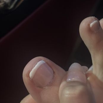 Elegant Nails - dip in right side, its a dark spot because it was bleeding - Massage Near Me - Christiansburg, Virginia Elegant Nails - dip in right side, its a dark spot because it was bleeding - Massage Near Me - Christiansburg, Virginia