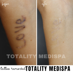 Totality Medispa