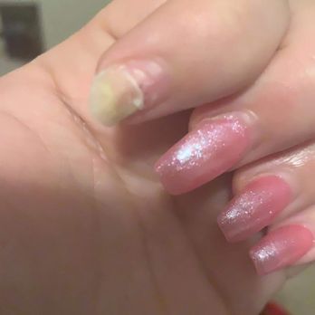 Shirley's Nails - Dead nail after 3 days wear! - Nail Salons Near Me - Lawton, Oklahoma