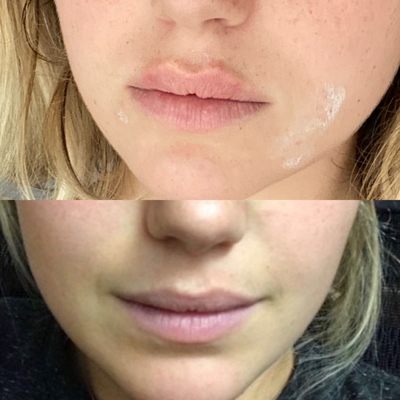 west valley medical aesthetics by null