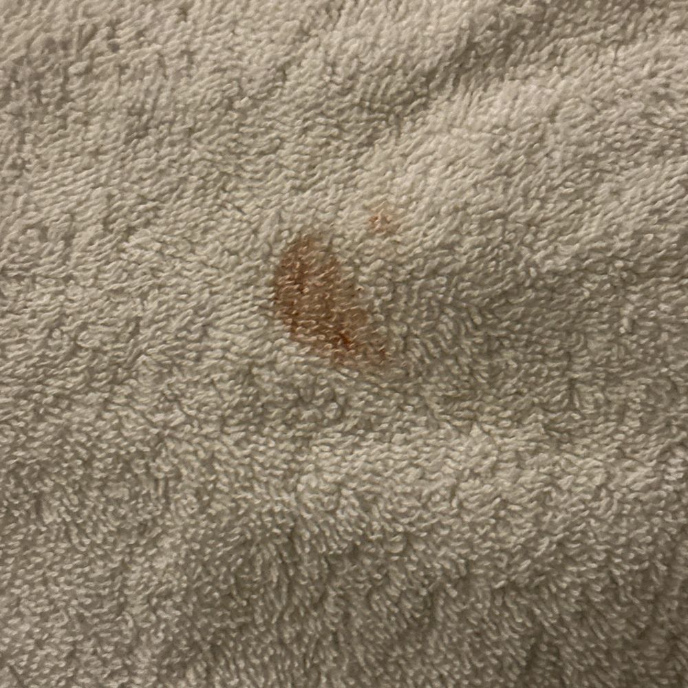Magnuson Hotel Park Vue - Blood stain on towel. - Hotels Near Me - Ely, Nevada Magnuson Hotel Park Vue - Blood stain on towel. - Hotels Near Me - Ely, Nevada