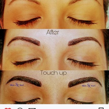 Skin Kari - Before and After - Skin Care Near Me - Maitland, Florida Skin Kari - Before and After - Skin Care Near Me - Maitland, Florida
