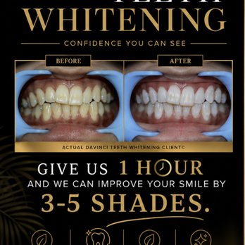 Organic Bronze Bar - Teeth Whitening Near Me - Hillsboro, Oregon Organic Bronze Bar - Teeth Whitening Near Me - Hillsboro, Oregon