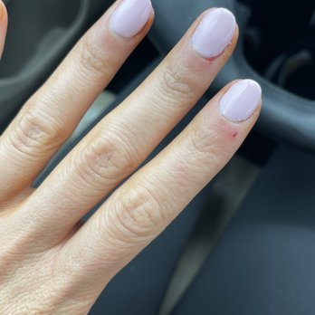 Polish Nail Spa - Nails after. So short and bleeding. - Nail Salons Near Me - Lake Forest, California Polish Nail Spa - Nails after. So short and bleeding. - Nail Salons Near Me - Lake Forest, California