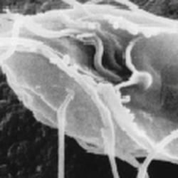 Warum ist es am Rhein so schön? - Wikipedia: Giardia lamblia, a parasitic flagellate that causes giardiasis