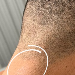 Clippers or shaver burn? I really hope this don't spread.
