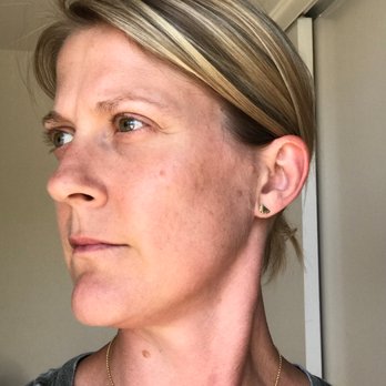The Skincare Boutique - Me before starting routine - skin is more uneven and less bright - Skin Care Near Me - Ladera Ranch, California