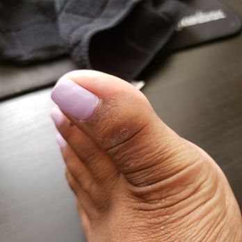 Grandlux Nails Lounge Dunvale - My nails weren't buffed down either, looking closely you can see ridges/bumps in my big toe nail. - Nail Salons Near Me - Houston, Texas Grandlux Nails Lounge Dunvale - My nails weren't buffed down either, looking closely you can see ridges/bumps in my big toe nail. - Nail Salons Near Me - Houston, Texas