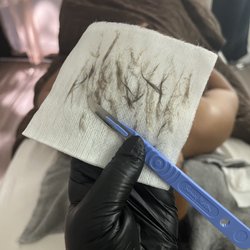 Touched with Agape - Dermaplaning