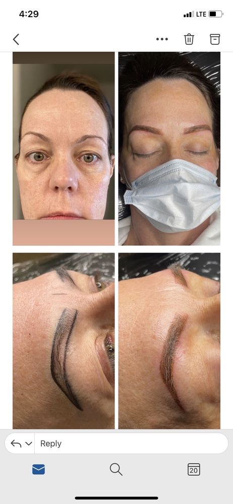 Fine Lines Dermal Services Logo