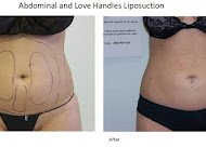 GG Body Contour & Esthetics Logo