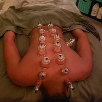 Tranquil Massage & Spa - Cupping Therapy - Massage Therapy Near Me Tranquil Massage & Spa - Cupping Therapy - Massage Therapy Near Me