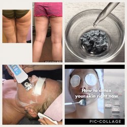 Spotless Skin Spa - One spot shop.. i offer variety of services:)