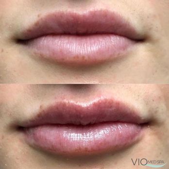 VIO Med Spa - Medical Spas Near Me - Paramus, New Jersey VIO Med Spa - Medical Spas Near Me - Paramus, New Jersey